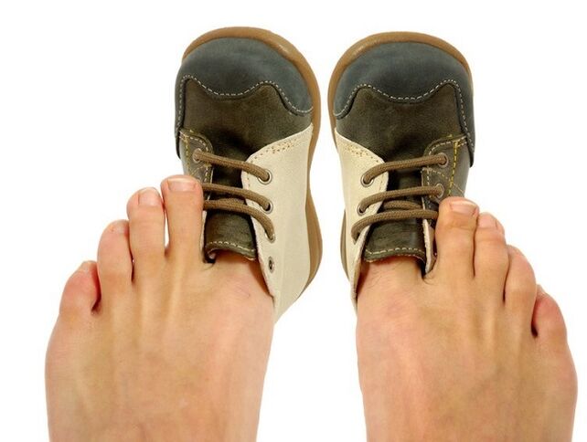 těsné boty jako příčina plísní mezi prsty