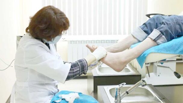 Dermatolog léčí plísně nehtů na nohou